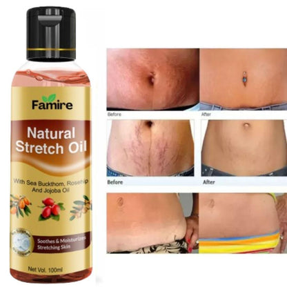 Famire Natural Stretch Oil 100ML