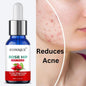 Rose Hip Face Serum 30ML